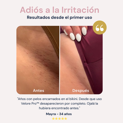 Velore Pro™ Depiladora Corporal 2 en 1 [Resultado Perfecto]