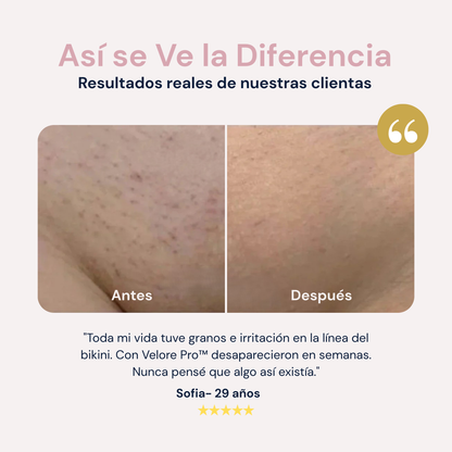 Velore Pro™ Depiladora Corporal 2 en 1 [Resultado Perfecto]
